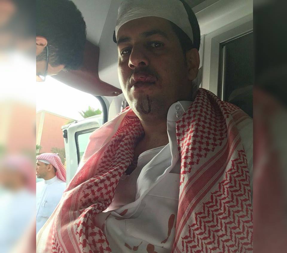 القبض على أمير سعودي بعد اعتداءه على مغترب يمني